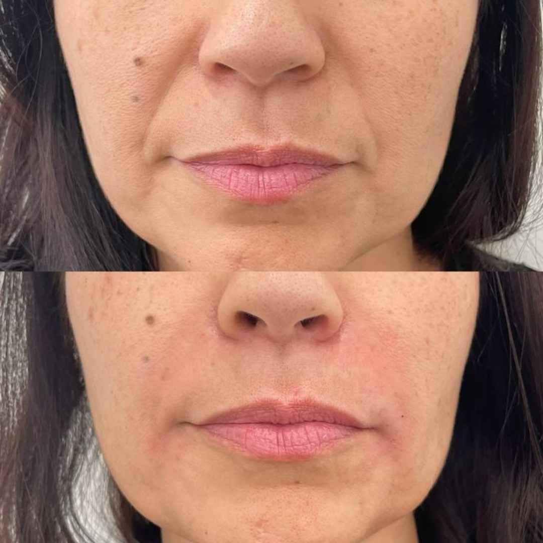Crema SeoulGlow™ 1988: Retinal Liposoma 1% + Arroz Fermentado